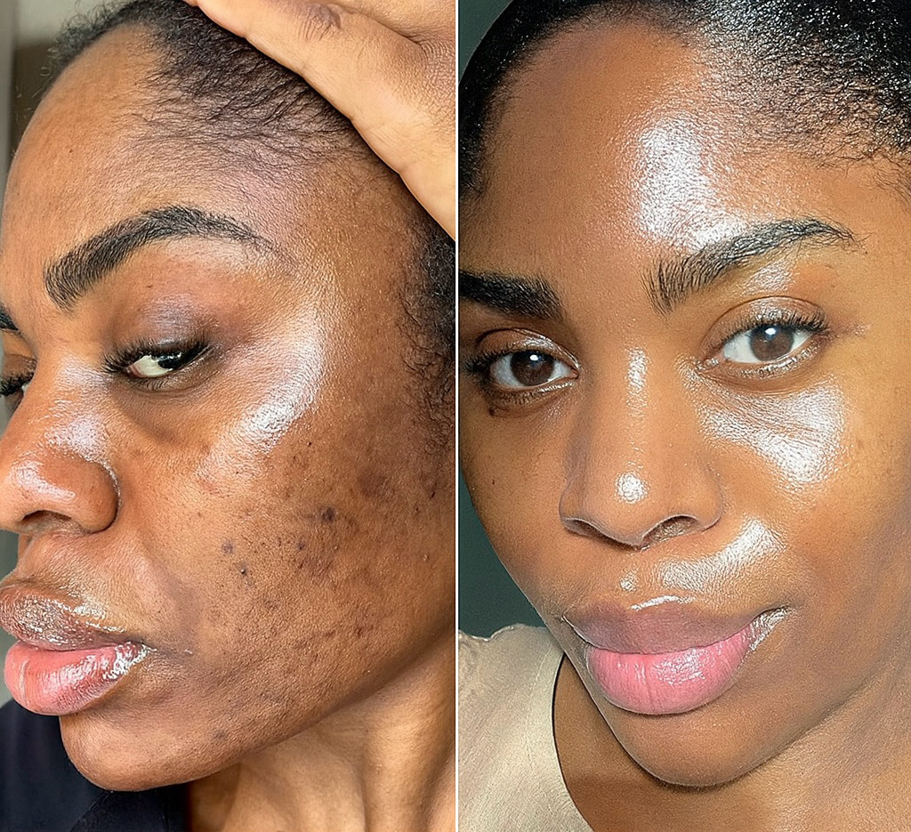 After - Glowsy AcneClear Face Wash